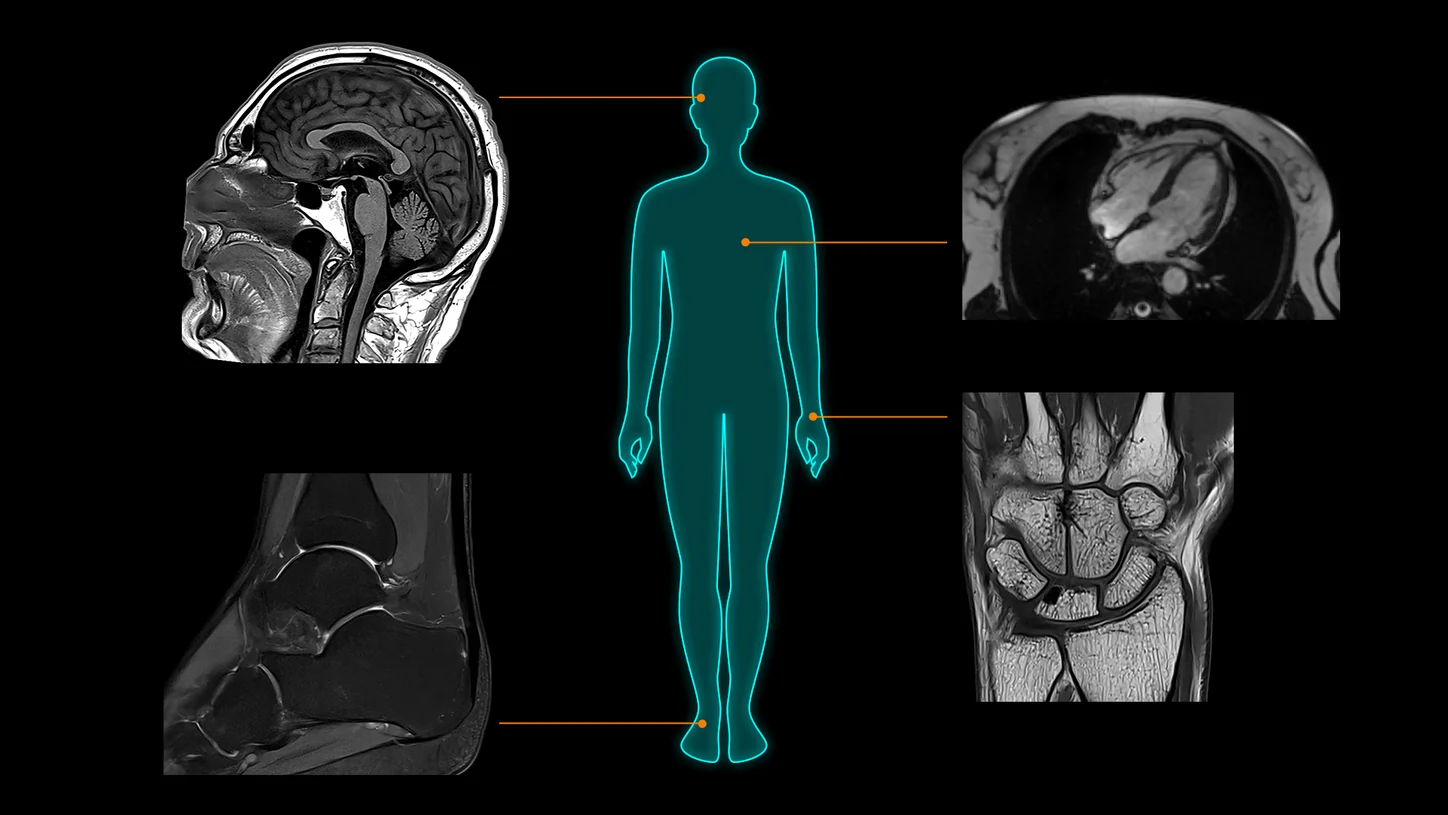 Examples of MAGNETOM Flow clinical imaging applications