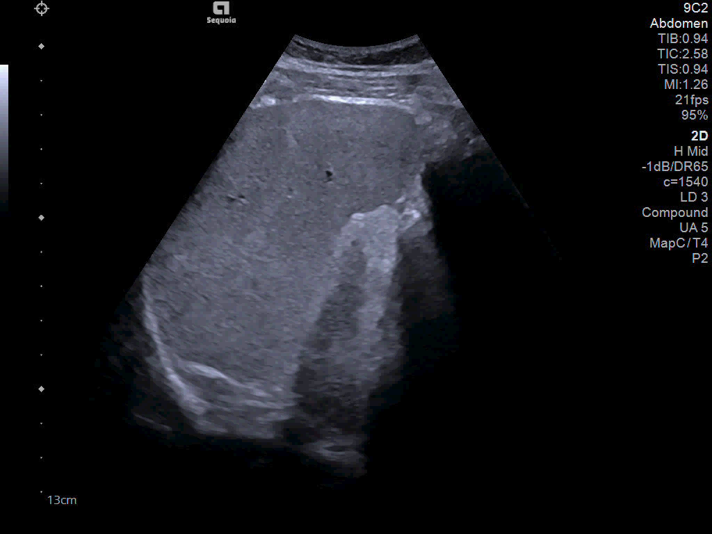 Illustrative InFocus ultrasound image